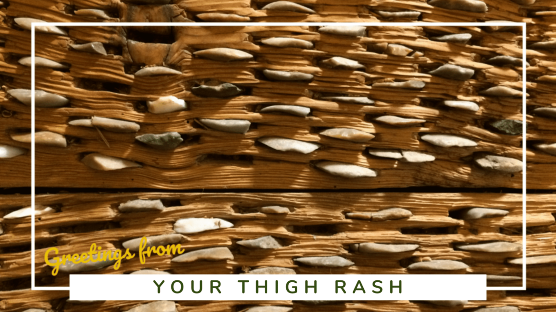 How to Prevent Chafing And Thigh Rash - SittingUnderAPalmTree